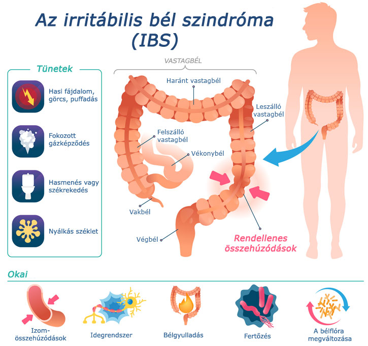 IBS infografika