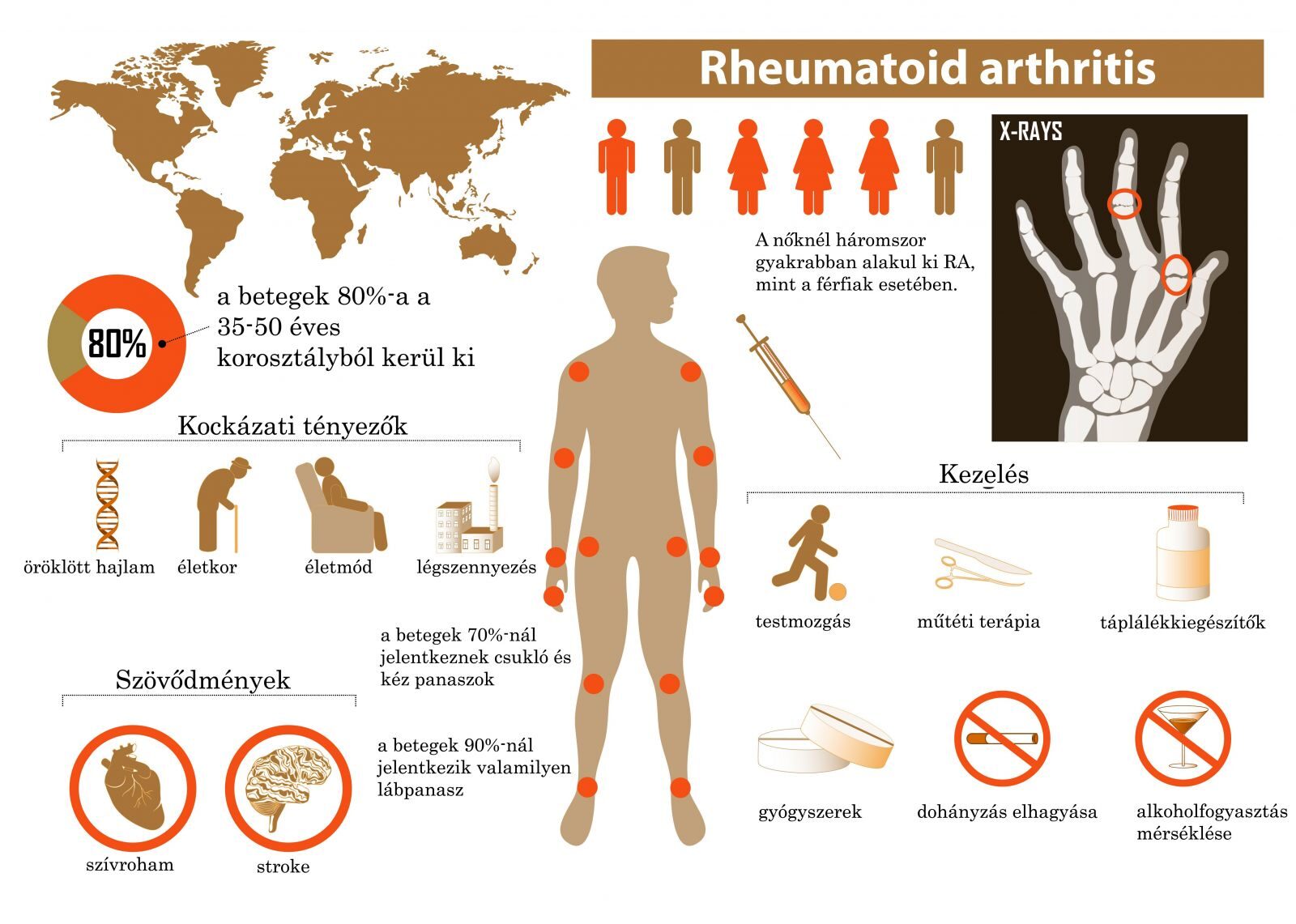 mely ízületeket nem érinti a rheumatoid arthritis